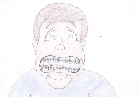 Free from jail: several years of braces worth it